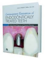 Contemporary Restoration of Endodontically Treated Teeth: Evidence-Based Diagnosis and Treatment Planning 086715571X Book Cover