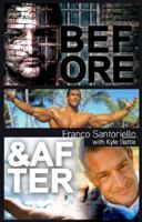 Before and After: Franco Santoriello with Kyle Battle 0578438267 Book Cover