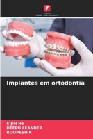Implantes em ortodontia (Portuguese Edition) 6208758475 Book Cover