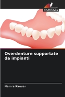 Overdenture supportate da impianti 6206243141 Book Cover