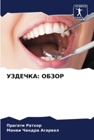 УЗДЕЧКА: ОБЗОР 620724107X Book Cover
