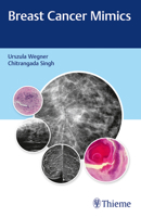 Breast Cancer Mimics 9388257944 Book Cover
