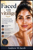 Faced with vitiligo: Your Essential Guide to Treatment, Skin Care, and Living Confidently with Vitiligo B0H96BVYXF Book Cover