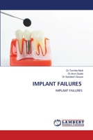 Implant Failures 6207474546 Book Cover