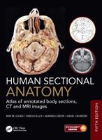 Human Sectional Anatomy: Atlas of Body Sections, CT and MRI Images 1041142749 Book Cover