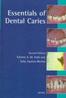 Essentials of Dental Caries 0192626922 Book Cover