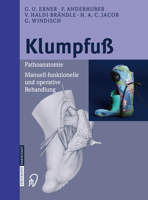 Klumpfuß: Pathoanatomie, Manuell Funktionelle Und Operative Behandlung 3798514852 Book Cover