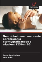 Neuroblastoma: znaczenie obrazowania scyntygraficznego z uzyciem 123I-mIBG (Polish Edition) 6630018818 Book Cover