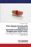 Rak Predstatel'noy Zhelezy I Tsitomegalovirusnaya Infektsiya Prostaty 3659227382 Book Cover