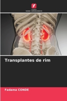 Transplantes de rim (Portuguese Edition) 6202031085 Book Cover