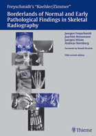 Koehler/Zimmer's Borderlands of Normal and Early Pathological Findings in Skeletal Radiography 1588901505 Book Cover