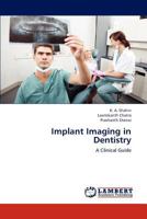 Implant Imaging in Dentistry: A Clinical Guide 3659184039 Book Cover