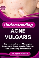 UNDERSTANDING ACNE VULGARIS: Expert Insights for Managing Breakouts, Restoring Confidence, and Promoting Skin Health B0FRL945DB Book Cover