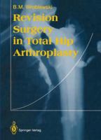 Revision Surgery in Total Hip Arthroplasty 3540196188 Book Cover