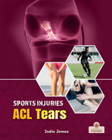 ACL Tears (Sports Injuries) 1039880797 Book Cover