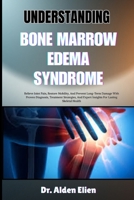 UNDERSTANDING BONE MARROW EDEMA SYNDROME: Relieve Joint Pain, Restore Mobility, And Prevent Long-Term Damage With Proven Diagnosis, Treatment ... Expert Insights For Lasting Skeletal Health B0HBLZ8KQZ Book Cover