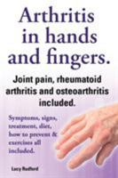 Arthritis in Hands and Arthritis in Fingers. Rheumatoid Arthritis and Osteoarthritis Included. Symptoms, Signs, Treatment, Diet, How to Prevent & Exer 1909151610 Book Cover