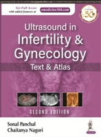 Ultrasound in Infertility and Gynecology 9389129982 Book Cover