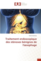 Traitement endoscopique des sténoses bénignes de l'oesophage 6203418781 Book Cover