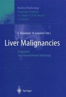 Liver Malignancies: Diagnostic and Interventional Radiology 3540647562 Book Cover