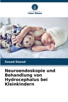Neuroendoskopie und Behandlung von Hydrocephalus bei Kleinkindern 6205704757 Book Cover