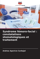 Syndrome fémoro-facial: constatations stomatologiques et traitement 6206301281 Book Cover