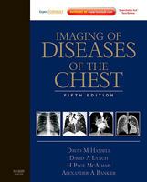 Imaging of Diseases of the Chest: Expert Consult - Online and Print, 5e 0723434964 Book Cover