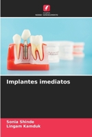 Implantes imediatos (Portuguese Edition) 6208631483 Book Cover