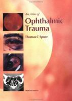 An Atlas of Ophthalmic Trauma 1853172995 Book Cover