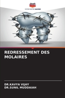 Redressement Des Molaires (French Edition) 6630040376 Book Cover