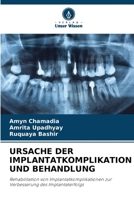 URSACHE DER IMPLANTATKOMPLIKATION UND BEHANDLUNG: Rehabilitation von Implantatkomplikationen zur Verbesserung des Implantaterfolgs 6206013421 Book Cover