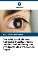 Die Wirksamkeit von Kollagen-Punctal-Plugs bei der Behandlung des Syndroms des trockenen Auges (German Edition) 6208108810 Book Cover