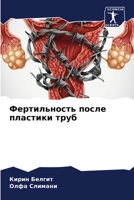 Фертильность после плас& 6204040979 Book Cover