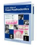 Color Atlas of Fixed Prosthodontics 4781203205 Book Cover