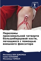 Переломы проксимальной четверти большеб& 6205899515 Book Cover