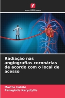 Radiação nas angiografias coronárias de acordo com o local de acesso (Portuguese Edition) 663004553X Book Cover