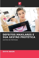 Defeitos Maxilares E Sua Gestão Protética 6206296857 Book Cover