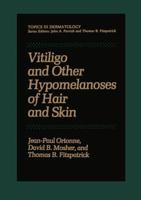 Vitiligo and Other Hypomelanoses of Hair and Skin 1461592747 Book Cover