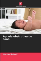 Apneia obstrutiva do sono 6209632556 Book Cover