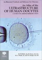 An Atlas of the Ultrastructure of Human Oocytes: A Guide for Assisted Reproduction (The Encyclopedia of Visual Medicine Series) 185070404X Book Cover