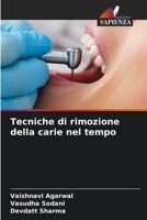 Tecniche di rimozione della carie nel tempo (Italian Edition) 6207529294 Book Cover