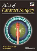 Atlas of Cataract Surgery 0071634452 Book Cover