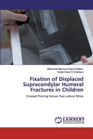 Fixation of Displaced Supracondylar Humeral Fractures in Children 6200540632 Book Cover