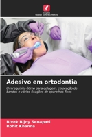 Adesivo in ortodonzia (Italian Edition) 6206441814 Book Cover