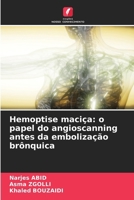 Hemoptise maciça: o papel do angioscanning antes da embolização brônquica (Portuguese Edition) 6208242991 Book Cover