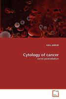 Cytology of cancer: cervix postradiation 3639294181 Book Cover