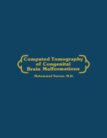 Computed Tomography of Congenital Brain Malformations 0898386950 Book Cover