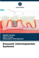 Enossale Zahnimplantat-Systeme 6203507458 Book Cover