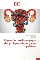 Reparation coelioscopique des prolapsus des organes pelviens 6206706419 Book Cover