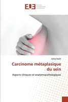 Carcinome métaplasique du sein 6203423203 Book Cover
